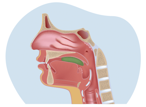 Diagram - Dysphagia